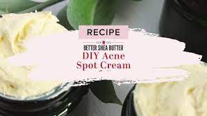 diy acne spot cream home remedy for