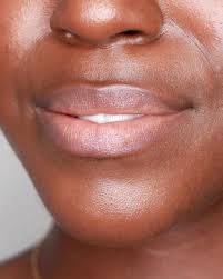how to cure dry lips lakisha adams