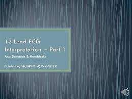 12 Lead Ecg Interpretation Part 1 Authorstream