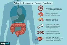 gardner syndrome symptoms treatment