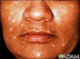 skin abnormally dark or light
