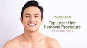 face laser hair removal for men in