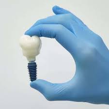 implantologie dentara implant dentar