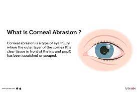 corneal abrasion causes treatment