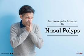 best homeopathic treatment for nasal