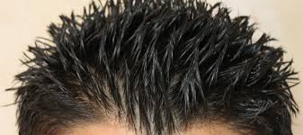 growth of hair after fue maral hair