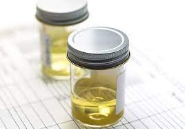 what is the chemical position of urine