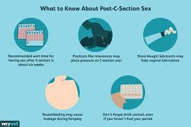 When Can You Have Sex After A C Section