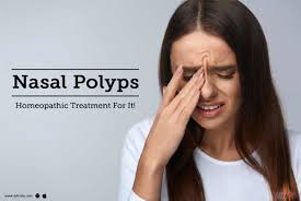 nasal polyps homeopathic treatment