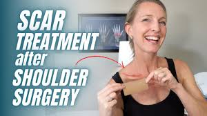 shoulder lipoma surgery scar treatment