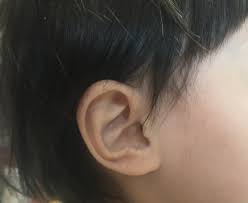 耳鼻科 耳掃除 子供
