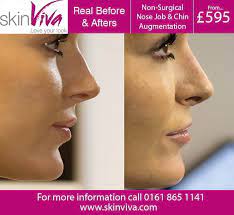 claire hobson nose reshaping skinviva
