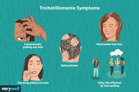 trichotillomania hair pulling disorder
