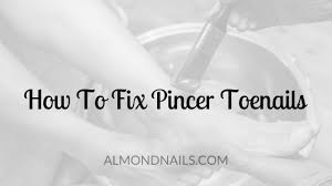 how to fix pincer toenails what you