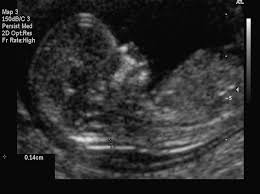 Diagnostic Obstetric Ultrasound Glowm