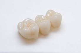 セラミック歯 | 美容専門の歯科 表参道デンタルクリニック
