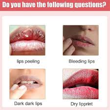 lip lightening brightener for dark lips