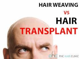 When it's done, it does not. Exactly Difference Between Hair Weaving And Hair Transplant