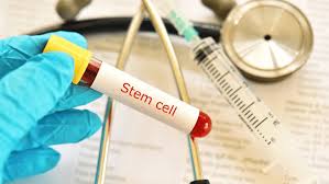 stem cell for hair treatment