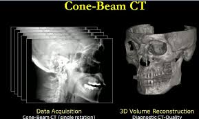 evolution of cbct an academic and