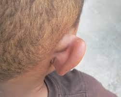a boy with a p behind the ear