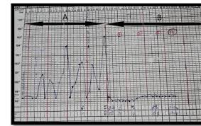 Temperature Chart Of The Patient A Meropenem B Co