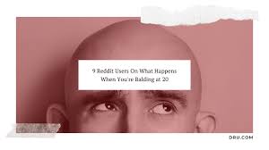 9 reddit users on balding at 20