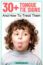 30 tongue tie signs and how to treat