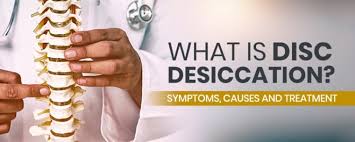 what is disc desiccation symptoms