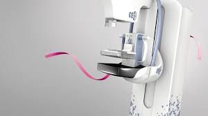 What Is Digital Mammography And Breast Tomosynthesis Mayfair
