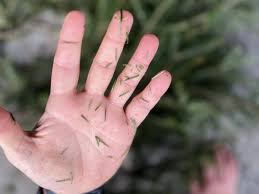 how to clean pine tree sap from skin