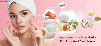 homemade face masks for acne and blackheads