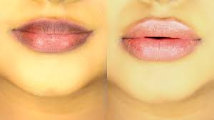 how to lighten dark lips fast naturally