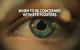 when to be concerned with eye floaters