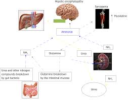The liver is unable to perform its vital functions of many people think that only drinking excessive amounts of alcohol causes liver cirrhosis. Sarcopenia And Cognitive Impairment In Liver Cirrhosis A Viewpoint On The Clinical Impact Of Minimal Hepatic Encephalopathy