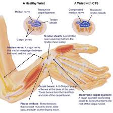 Tendons are similar to ligaments; Common Hand And Wrist Conditions Boston Orthopaedic Spine