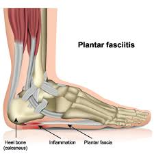 best shoes for plantar fasciitis relief