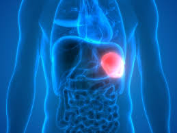 An enlarged spleen puts one at risk for rupture, said. A Prof Jaber Diseases Of The Spleen