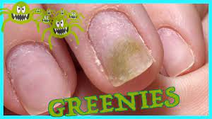greenies again nail pro