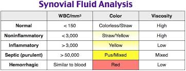 Synovial Fluid Analysis Medical Laboratory Nursing