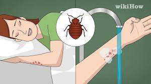 how to treat bed bug bites 12 steps