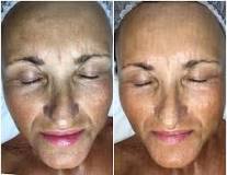 can-massaging-your-face-sculpt-it