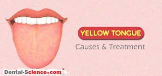 yellow tongue causes and treatment