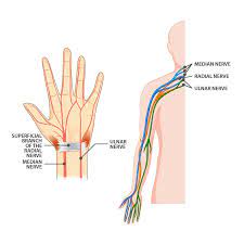 ring finger numbness exercises