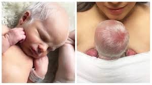 Whose good looks will your baby inherit? I Gave Birth To The Babies With White Hair Cafemom Com