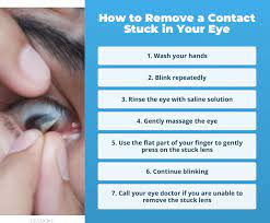 remove a contact lens stuck in your eye