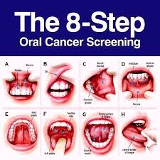 cancer screenings are the dental