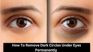 how to remove dark circles under eyes
