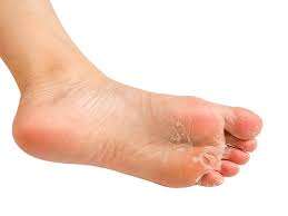 how to get rid of athlete s feet