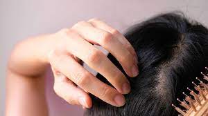 How to keep your hair looking fresh for fall. Hair Loss In Women 14 Treatments For Females